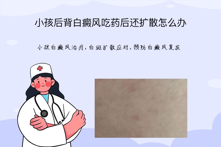 小孩后背白癜风吃药后还扩散怎么办”