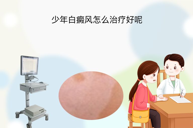 少年白癜风怎么治疗好呢”
