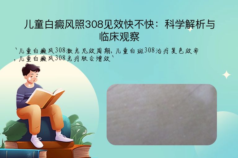 儿童白癜风照308见效快不快:科学解析与临床观察