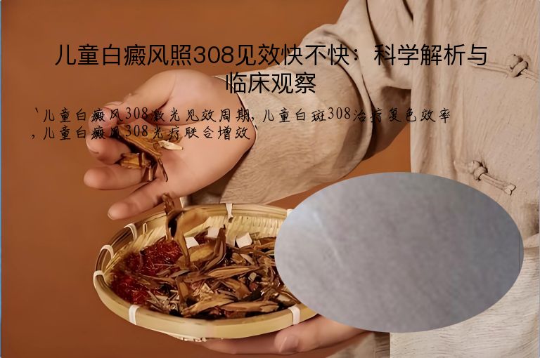 儿童白癜风照308见效快不快：科学解析与临床观察