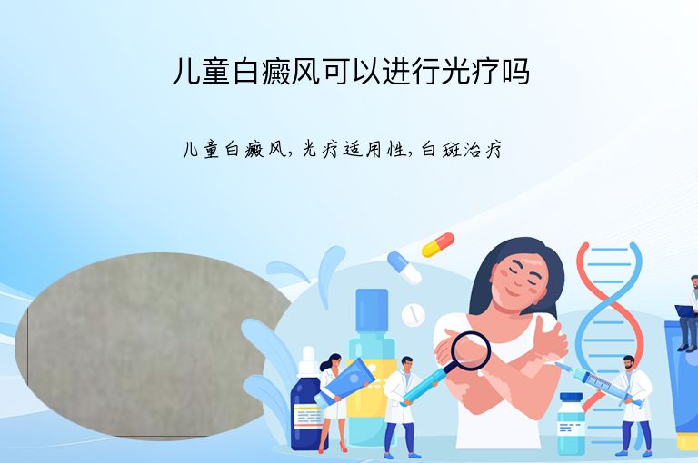 儿童白癜风可以进行光疗吗”