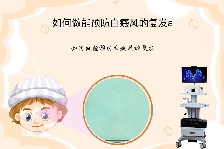 如何做能预防白癜风的复发a”