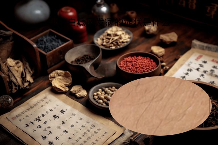 少年白癜风发病的症状是什么”