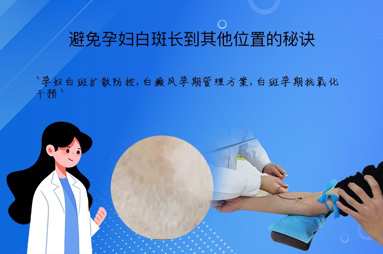 避免孕妇白斑长到其他位置的秘诀