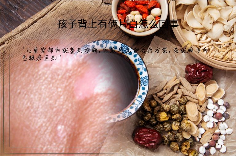 孩子背上有俩片白怎么回事