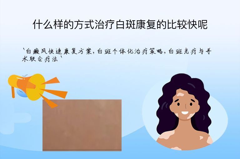什么样的方式治疗白斑康复的比较快呢