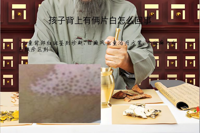 孩子背上有俩片白怎么回事
