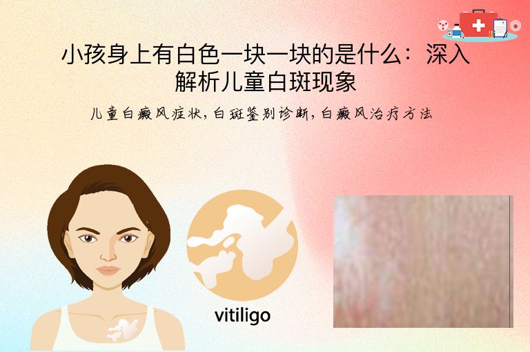 小孩身上有白色一块一块的是什么：深入解析儿童白斑现象”