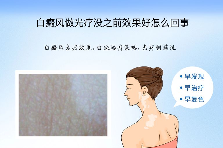 白癜风做光疗没之前效果好怎么回事”