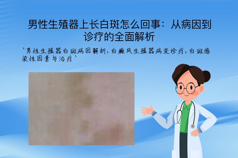男性生殖器上长白斑怎么回事：从病因到诊疗的全面解析