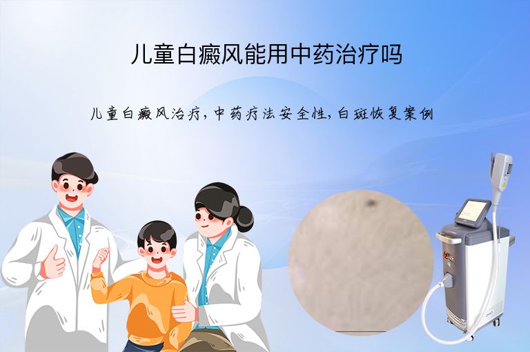 儿童白癜风能用中药治疗吗”