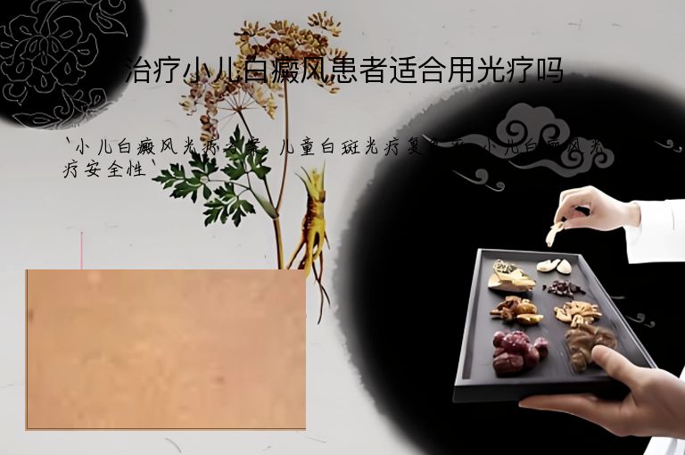 治疗小儿白癜风患者适合用光疗吗