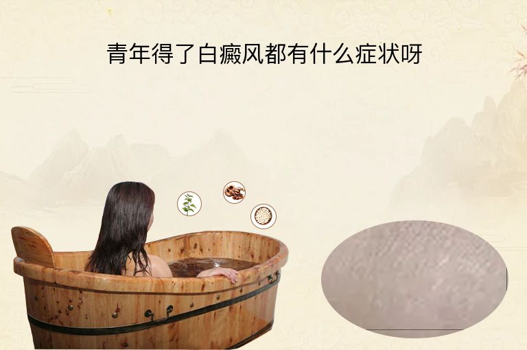 青年得了白癜风都有什么症状呀”