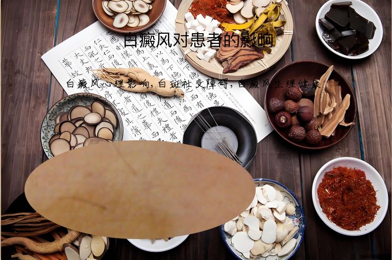 https://www.bdfsjzyy.com/d/file/p/6d3bd9f1fea3027c46d86f4dbf7a44ec.jpeg