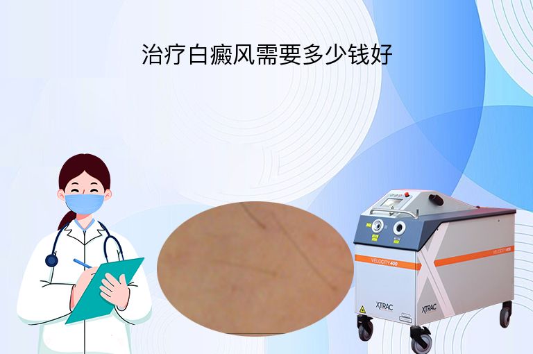 治疗白癜风需要多少钱好”
