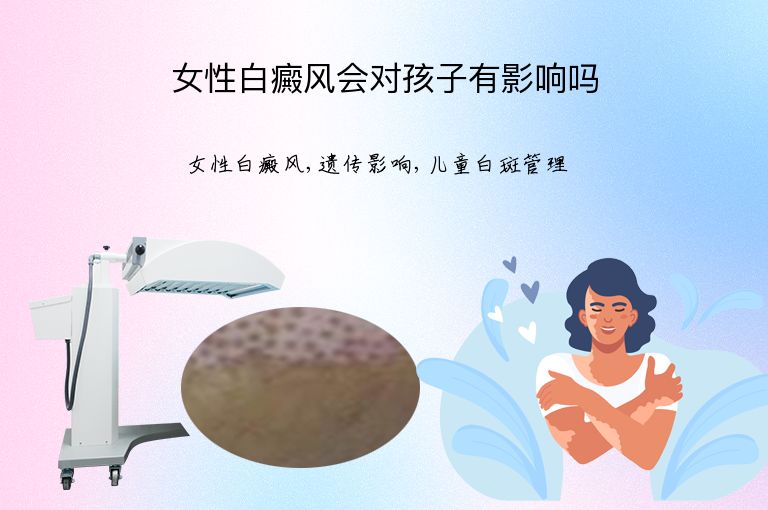 女性白癜风会对孩子有影响吗”