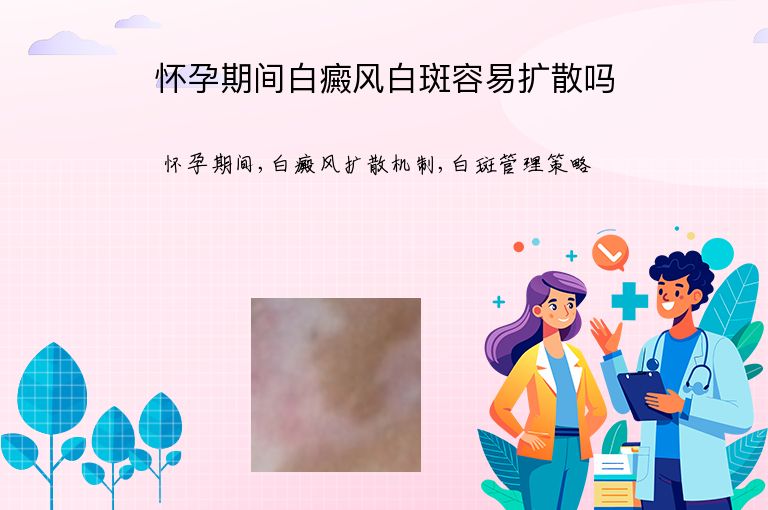 怀孕期间白癜风白斑容易扩散吗”