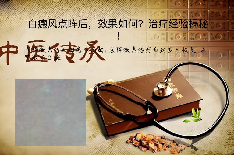 白癜风点阵后，效果如何？治疗经验揭秘！”