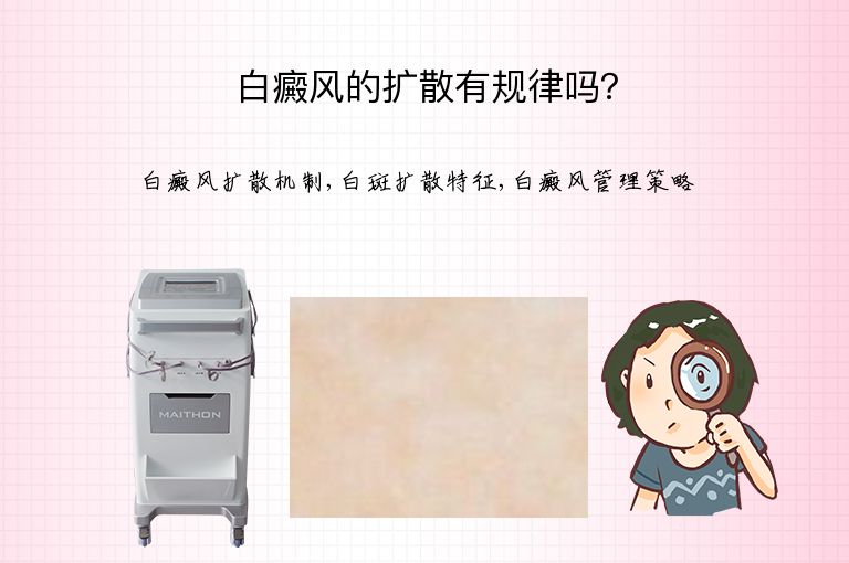 白癜风的扩散有规律吗?”