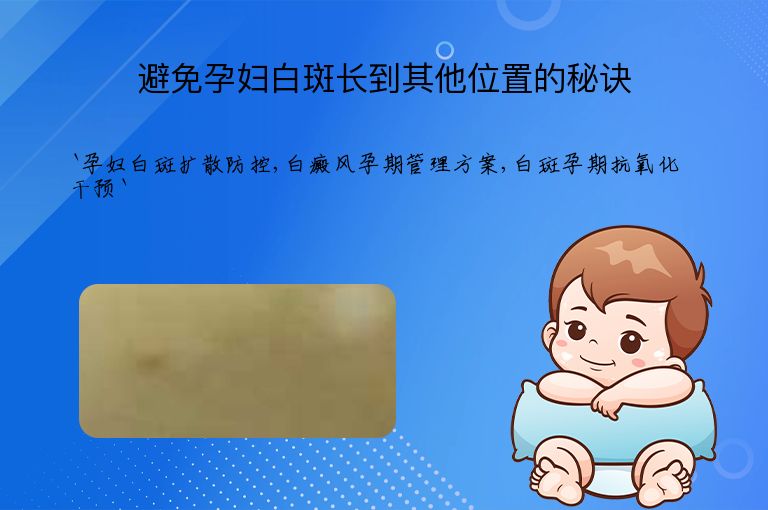 避免孕妇白斑长到其他位置的秘诀