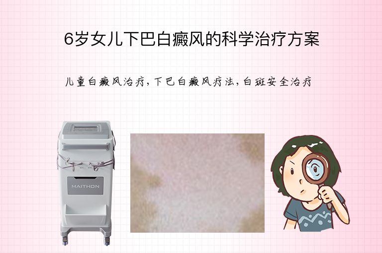 6岁女儿下巴白癜风的科学治疗方案”