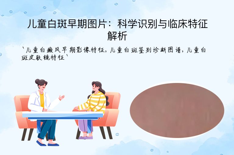 儿童白斑早期图片:科学识别与临床特征解析