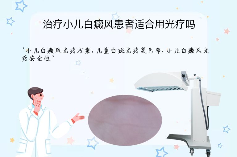 治疗小儿白癜风患者适合用光疗吗