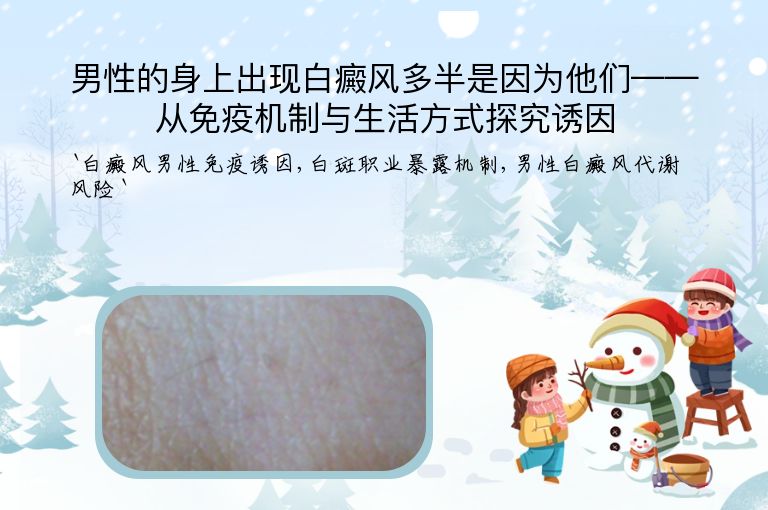 男性的身上出现白癜风多半是因为他们——从免疫机制与生活方式探究诱因