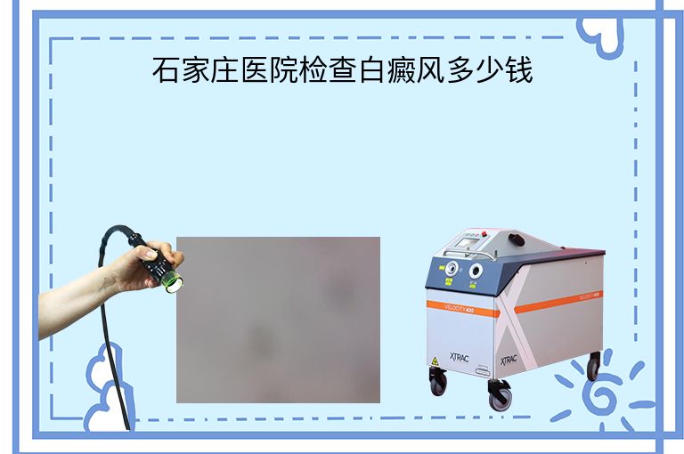 https://www.bdfsjzyy.com/d/file/p/ce911438c776b4d683b6af700ca3848f.jpeg