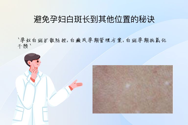 避免孕妇白斑长到其他位置的秘诀
