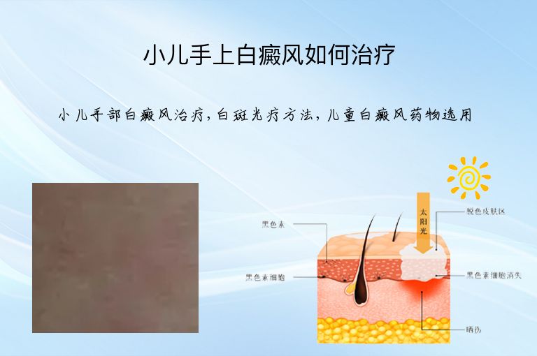 https://www.bdfsjzyy.com/d/file/p/9a525bbe2a3f50903edeaca454d5781e.jpeg