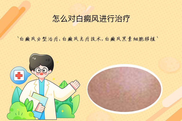 怎么对白癜风进行治疗”