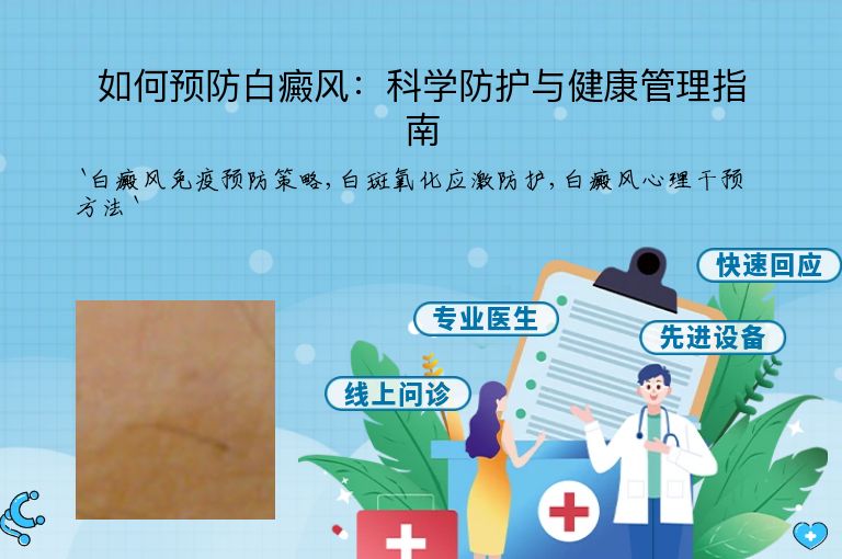 如何预防白癜风：科学防护与健康管理指南