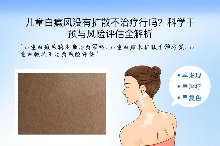 儿童白癜风没有扩散不治疗行吗？科学干预与风险评估全解析