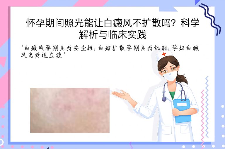 怀孕期间照光能让白癜风不扩散吗？科学解析与临床实践”