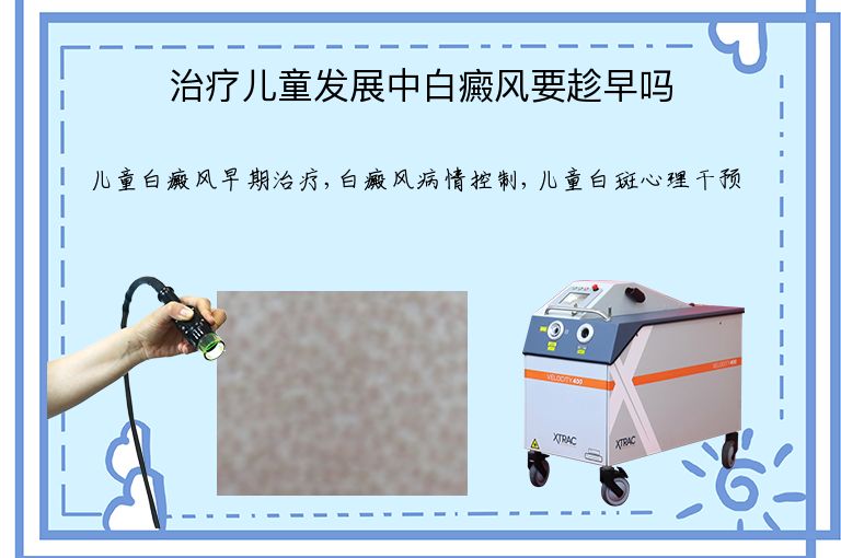 治疗儿童发展中白癜风要趁早吗”
