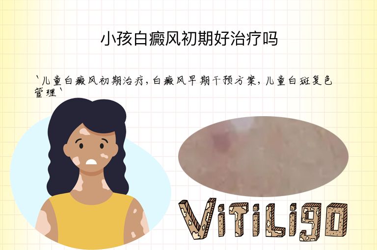 小孩白癜风初期好治疗吗