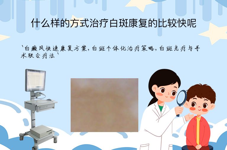 什么样的方式治疗白斑康复的比较快呢
