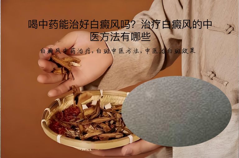 喝中药能治好白癜风吗?治疗白癜风的中医方法有哪些”