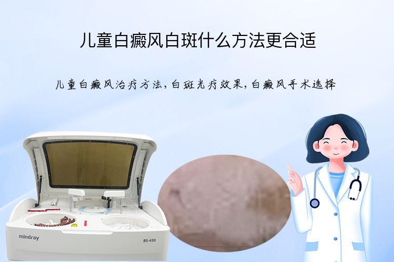 儿童白癜风白斑什么方法更合适”