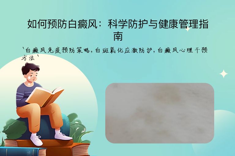如何预防白癜风:科学防护与健康管理指南