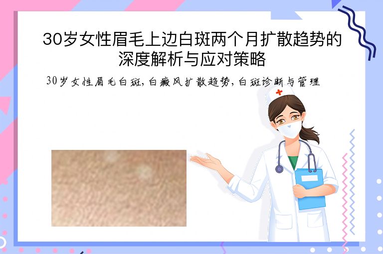 30岁女性眉毛上边白斑两个月扩散趋势的深度解析与应对策略”
