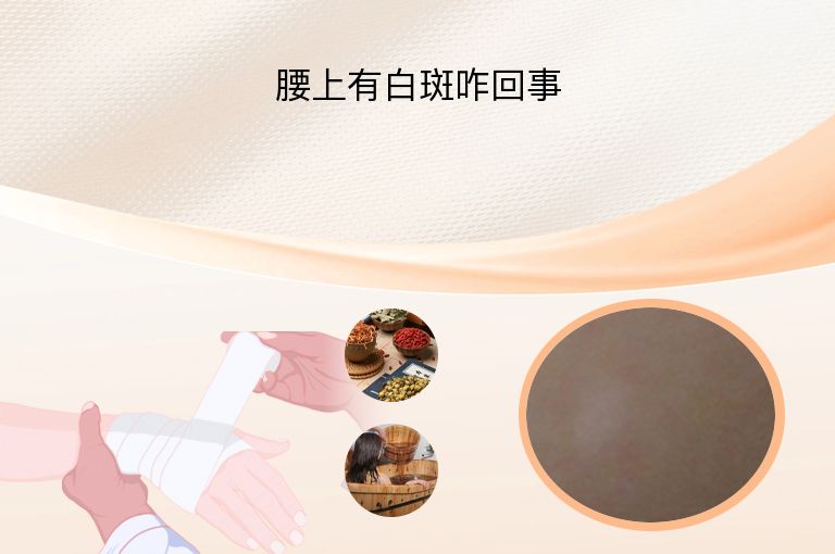 腰上有白斑咋回事”