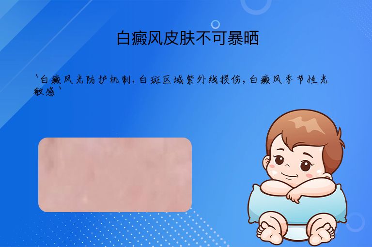白癜风皮肤不可暴晒