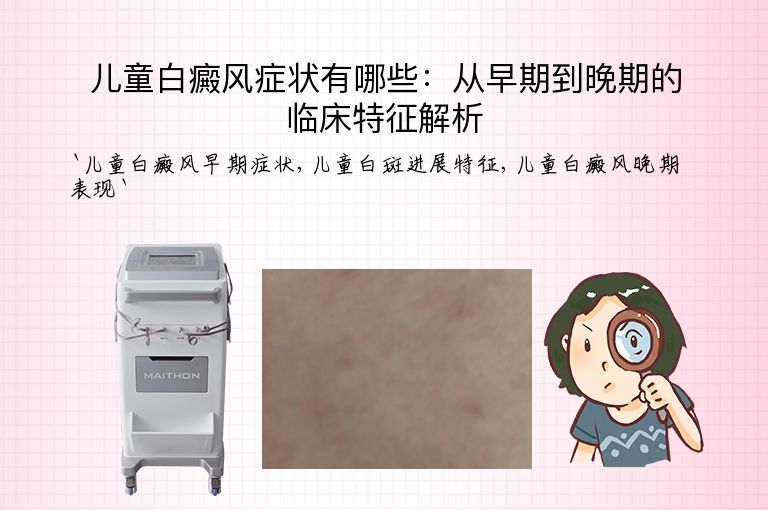 儿童白癜风症状有哪些:从早期到晚期的临床特征解析