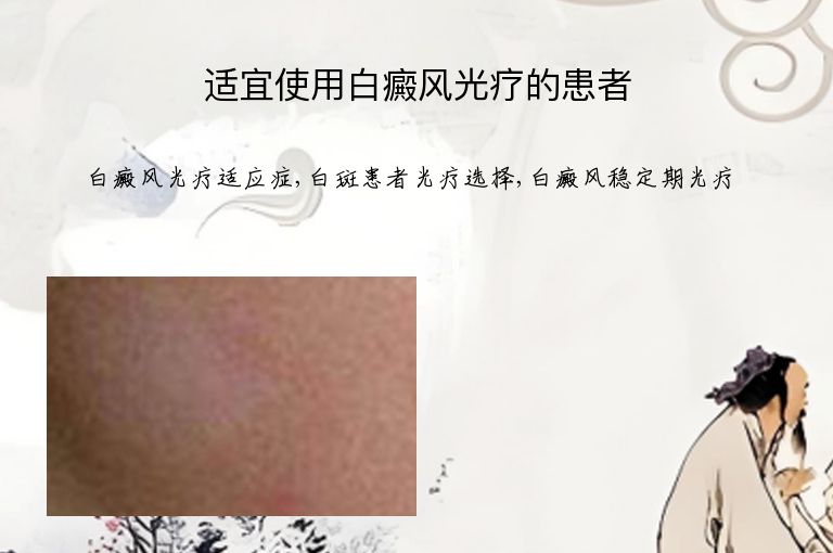 适宜使用白癜风光疗的患者”