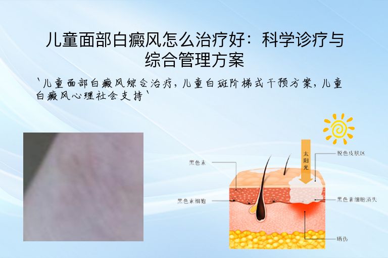 儿童面部白癜风怎么治疗好：科学诊疗与综合管理方案”