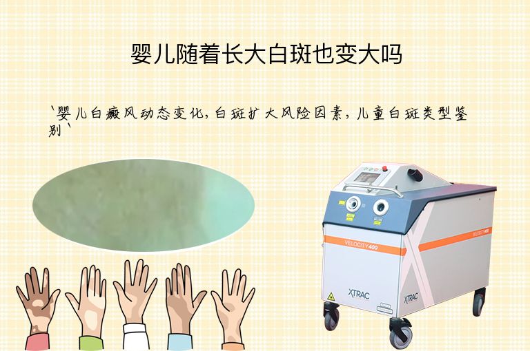https://www.bdfsjzyy.com/d/file/p/3273d9384de5d35669d826dfa8367845.jpeg