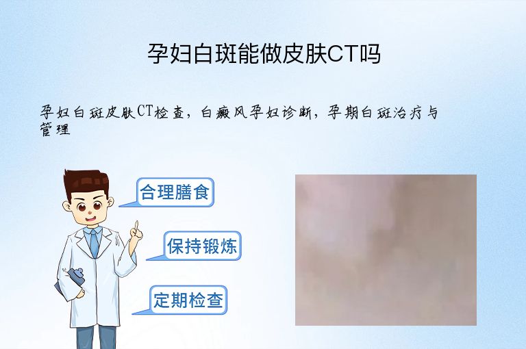 https://www.bdfsjzyy.com/d/file/p/9a04ce987dbe3fbb7090c4349d221676.jpeg
