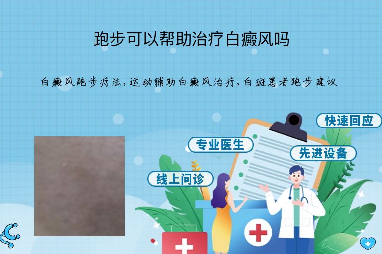 跑步可以帮助治疗白癜风吗”